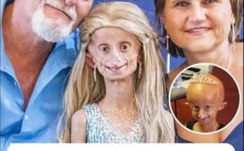 Beandri Booysen: Girl in South Africa with progeria dies