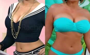 What Really Happened to Dylan Dreyer — The Moment NBC Tried to Cut Away